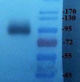 LOXL2 Rabbit Polyclonal Antibody