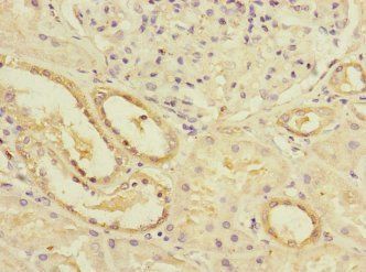 LPIN1 Antibody