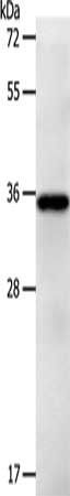 PLPPR5 Antibody