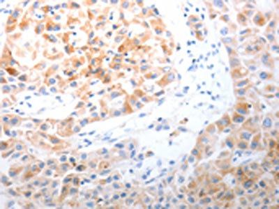 PLPPR5 Antibody