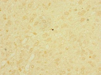 LRIG1 Antibody