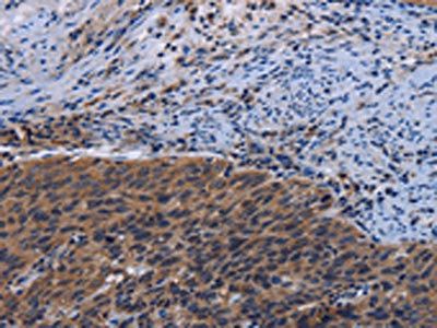 LRRC15 Antibody