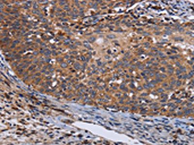 LRRC15 Antibody