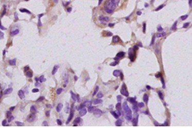 LTB4-R1 Rabbit Polyclonal Antibody