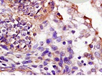 LTB4-R1 Rabbit Polyclonal Antibody