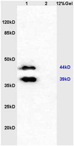 LTB4-R1 Rabbit Polyclonal Antibody