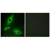 LTBR Antibody
