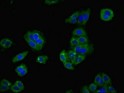 LY6H Antibody