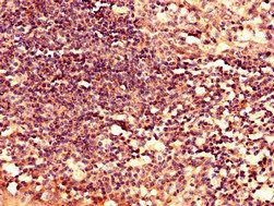 LY6H Antibody