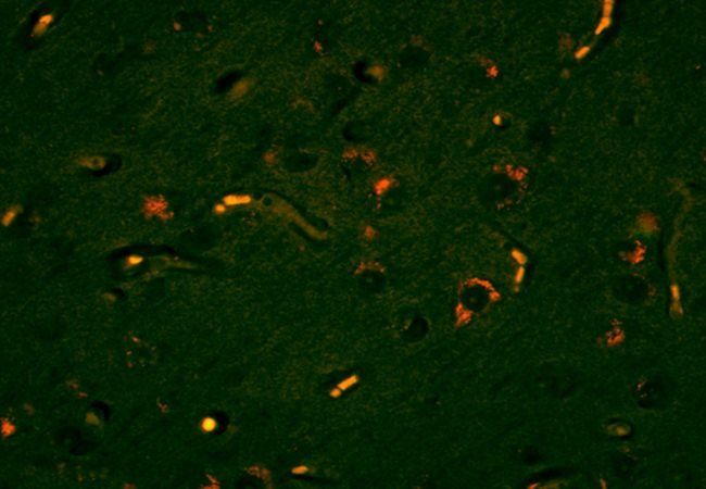 Lyn Rabbit Polyclonal Antibody (PE)