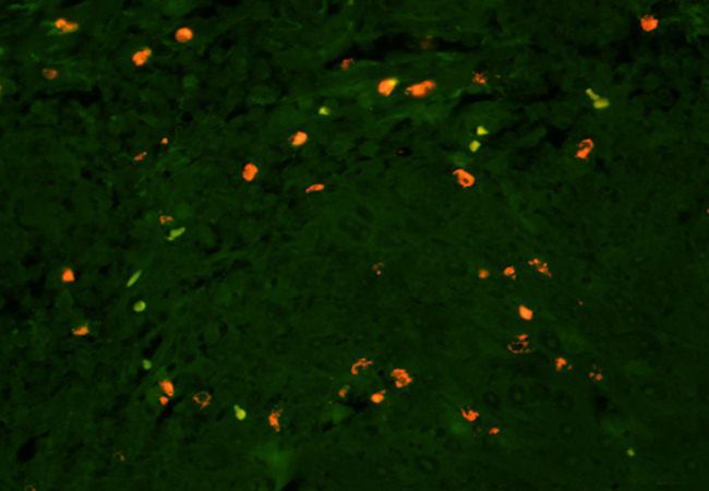 Lyn Rabbit Polyclonal Antibody (PE)