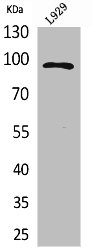 MACC1 Antibody
