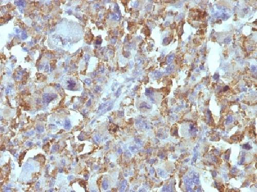 Macrophage & Histiocytoma Marker Antibody