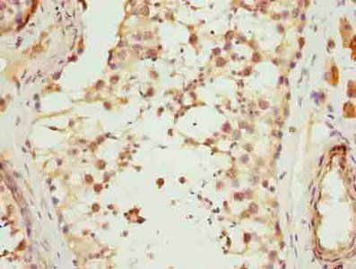 MAD2L1 Antibody