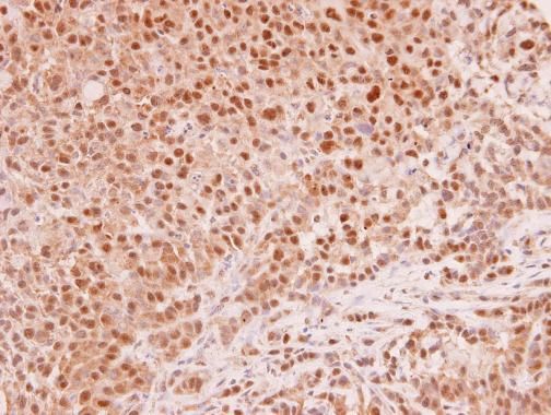 MAD2L1 Rabbit Polyclonal Antibody