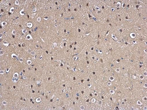 MAD2L1 Rabbit Polyclonal Antibody