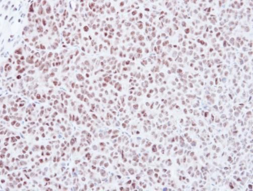 MAD2L1 Rabbit Polyclonal Antibody