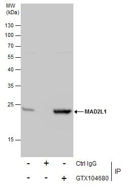 MAD2L1 Rabbit Polyclonal Antibody