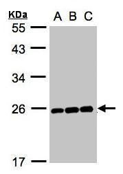 MAD2L1 Rabbit Polyclonal Antibody