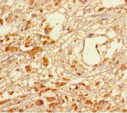 MAGEA5 Antibody