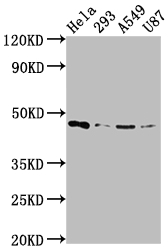 MAP2K1 Antibody