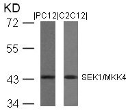MAP2K4 Antibody