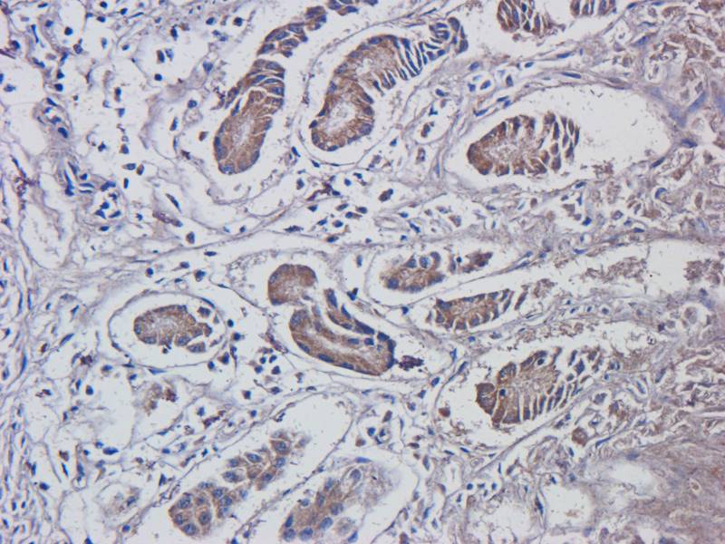 MAP2K7 Rabbit Polyclonal Antibody