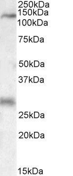 MAP3K6 Antibody