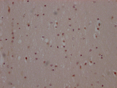 MAPK14 Antibody