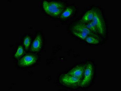 MAPRE2 Antibody