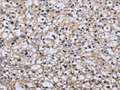 MAPRE3 Antibody