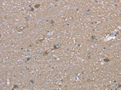 MAPRE3 Antibody