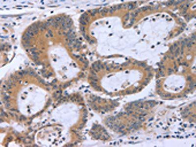 MAPRE3 Antibody