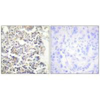 MARK3 Antibody