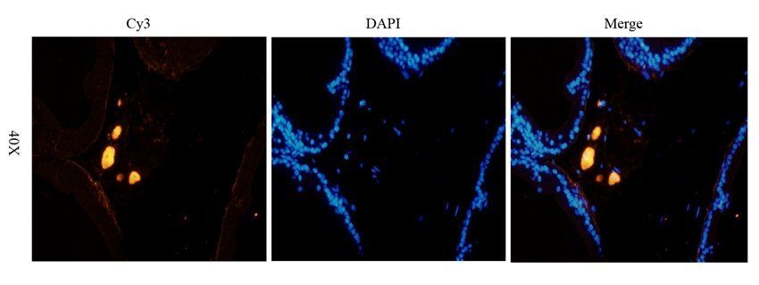 MASP2 Rabbit Polyclonal Antibody