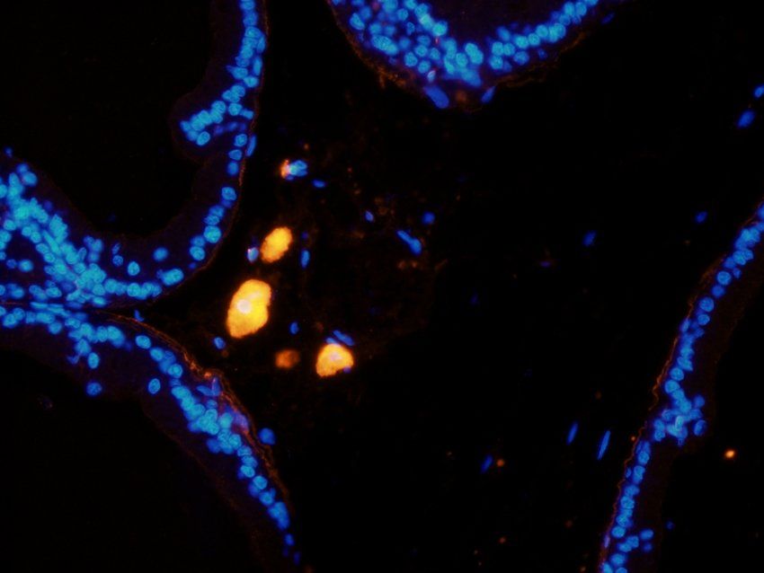 MASP2 Rabbit Polyclonal Antibody
