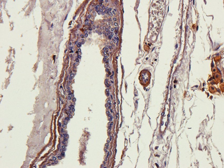 MASP2 Rabbit Polyclonal Antibody
