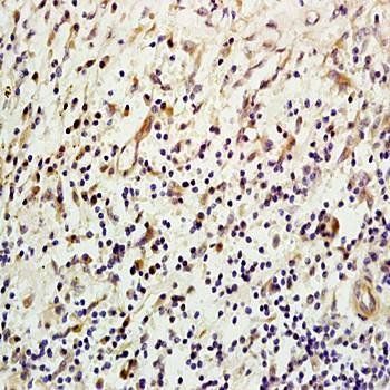 Mannan Binding Lectin Rabbit Polyclonal Antibody
