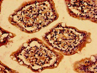 MC4R Antibody