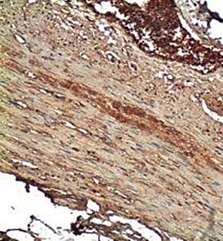 M-cadherin Rabbit Polyclonal Antibody