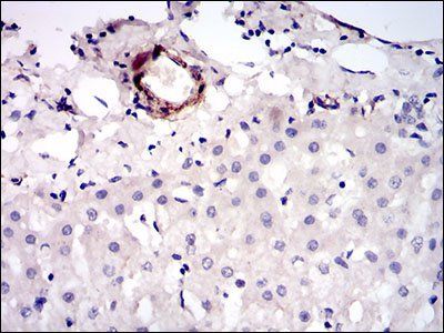 MCAM Antibody