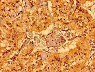 MCAT Antibody