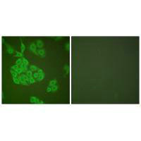 MCM5 Antibody