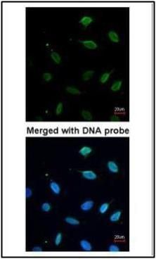 MCM7 Rabbit Polyclonal Antibody
