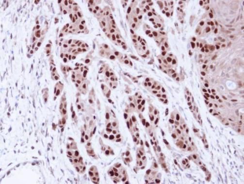 MCM7 Rabbit Polyclonal Antibody