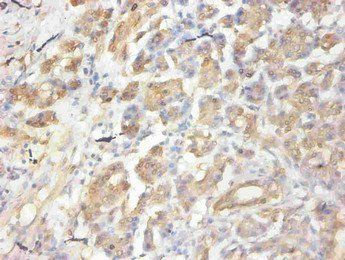 CCL2 Antibody