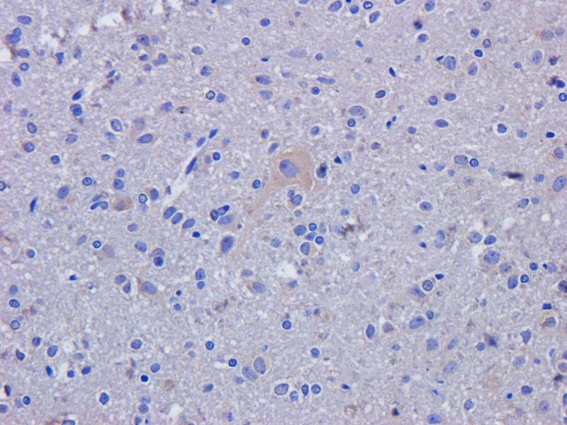 MCP1 Rabbit Polyclonal Antibody