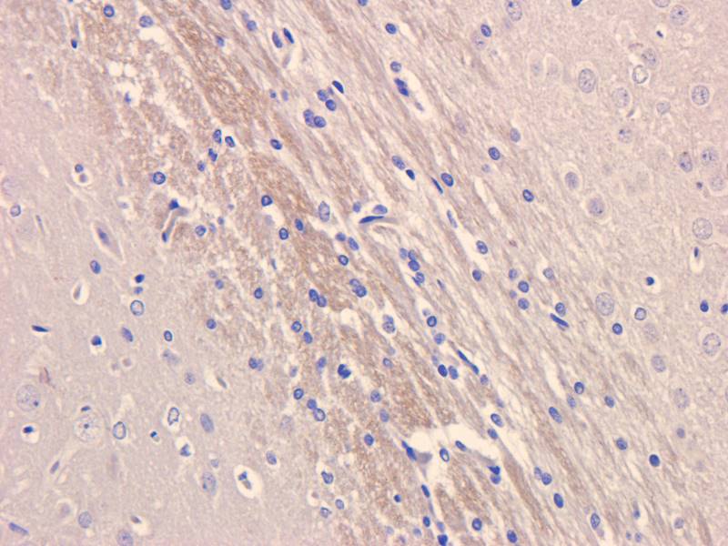 MCP1 Rabbit Polyclonal Antibody