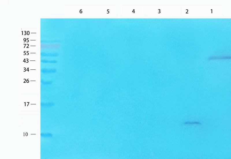 MCP1 Rabbit Polyclonal Antibody