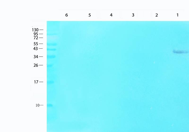 MCP1 Rabbit Polyclonal Antibody